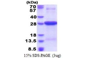 SDS-PAGE (SDS) image for HLA Class II DR alpha (HLA-DRA) (AA 26-216) protein (His tag) (ABIN5853581) (HLA-DRA Protein (AA 26-216) (His tag))