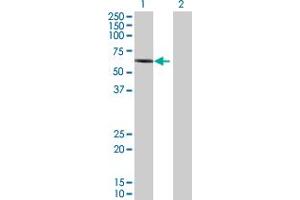 Western Blot analysis of RIPK2 expression in transfected 293T cell line by RIPK2 MaxPab polyclonal antibody. (RIPK2 anticorps  (AA 1-540))