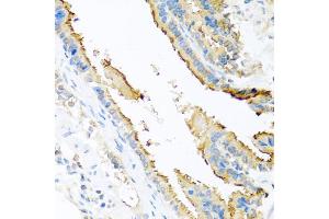 Immunohistochemistry of paraffin-embedded mouse lung using ApoE antibody (ABIN5975768) at dilution of 1/100 (40x lens). (APOE anticorps)