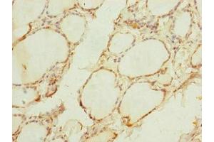 Immunohistochemistry of paraffin-embedded human thyroid tissue using ABIN7159887 at dilution of 1:100 (TIMM1B (AA 1-103) anticorps)