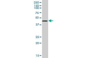 RING1 monoclonal antibody (M07), clone 4E8. (RING1 anticorps  (AA 81-170))