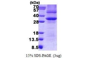 Image no. 1 for Prohibitin (PHB) protein (His tag) (ABIN1098557) (Prohibitin Protein (PHB) (His tag))