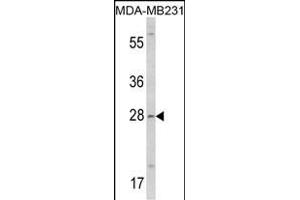 Western blot analysis of COLEC11 Antibody (N-term) (ABIN390822 and ABIN2841053) in MDA-M cell line lysates (35 μg/lane). (COLEC11 anticorps  (N-Term))