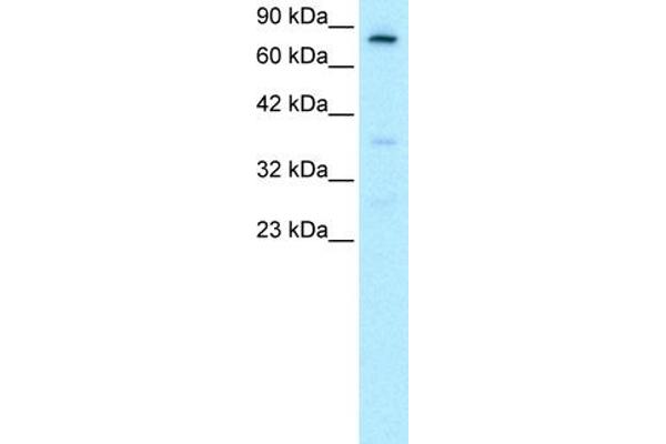 FOXE3 anticorps  (C-Term)