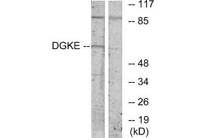 Western Blotting (WB) image for anti-Diacylglycerol Kinase, epsilon 64kDa (DGKE) (Internal Region) antibody (ABIN1849433) (DGKE anticorps  (Internal Region))