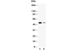 Western blot testing of KLF8 antibody and Lane 1:  SMMC-7721;  2: 293T cell lysate. (KLF8 anticorps  (N-Term))