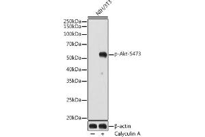 Western blot analysis of extracts of NIH/3T3 cells, using Phospho-Akt-S473 antibody (ABIN7265522) at 1:1000 dilution. (AKT 1/2/3 anticorps  (pSer472))