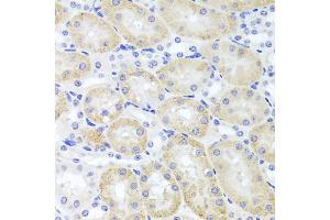 Immunohistochemistry of paraffin-embedded mouse kidney using ADIPOQ Antibody (ABIN5971370) at dilution of 1/100 (40x lens). (ADIPOQ anticorps)