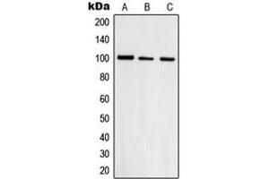 Western blot analysis of Topoisomerase 3 beta1 expression in HepG2 (A), A431 (B), HeLa (C) whole cell lysates. (Topoisomerase 3 Beta1 (N-Term) anticorps)