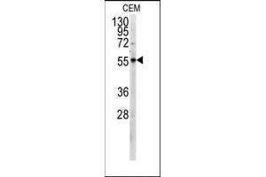 Western blot analysis of anti-PKM2 Antibody (C-term) in CEM cell line lysates (35ug/lane). (PKM2 anticorps  (C-Term))