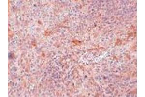 Immunohistochemistry (IHC) image for anti-TNFAIP3 Interacting Protein 3 (TNIP3) (C-Term) antibody (ABIN1030214) (TNIP3 anticorps  (C-Term))