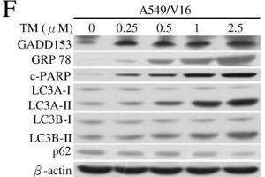 Western Blotting (WB) image for anti-Sequestosome 1 (SQSTM1) antibody (ABIN2854836)