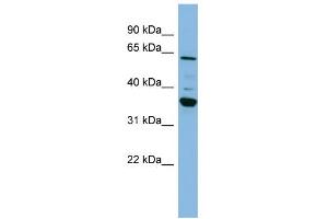 WB Suggested Anti-CYP3A7 Antibody Titration:  0. (CYP3A7 anticorps  (Middle Region))