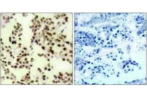 Immunohistochemistry (IHC) image for anti-Tumor Protein P73 (TP73) (pTyr99) antibody (ABIN2888508) (Tumor Protein p73 anticorps  (pTyr99))