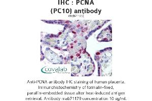 Image no. 1 for anti-Proliferating Cell Nuclear Antigen (PCNA) antibody (ABIN1724017) (PCNA anticorps)