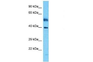 Host:  Rabbit  Target Name:  IRF1  Sample Tissue:  Human Esophagus Tumor  Antibody Dilution:  1ug/ml (IRF1 anticorps  (Middle Region))