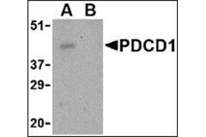 Western blot analysis of PD-1 in THP-1 cell lysate with this product at 1 μg/ml in the (A) absence and (B) presence of blocking peptide. (PD-1 anticorps  (Center))