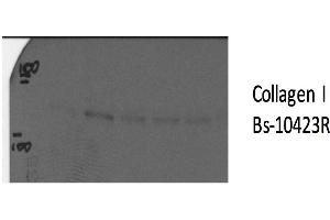 Western Blotting (WB) image for anti-Collagen, Type I (COL1) (AA 1051-1150) antibody (ABIN2173309)