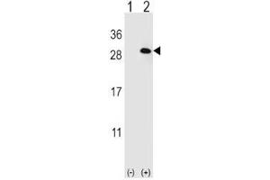 Western blot analysis of EIF4E2 antibody and 293 cell lysate (2 ug/lane) either nontransfected (Lane 1) or transiently transfected (2) with the EIF4E2 gene. (EIF4E2 anticorps)