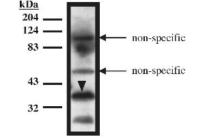 Western blot analysis using TUP1 antibody on recombinant TUP1 protein (amino acids 1-200) expressed in Mav108 cells. (HIRA anticorps)