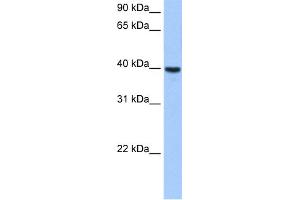 WB Suggested Anti-ST6GALNAC4 Antibody Titration:  0. (ST6GALNAC4 anticorps  (Middle Region))