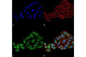 Immunocytochemistry/Immunofluorescence analysis using Rabbit Anti-WDR45 Polyclonal Antibody . (WDR45 anticorps  (AA 312-322) (FITC))