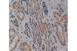 Used in DAB staining on fromalin fixed paraffin-embedded Heart tissue (NOSIP anticorps  (AA 62-295))