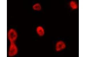 ABIN6275085 staining HepG2 by IF/ICC. (CCNB1IP1 anticorps  (Internal Region))