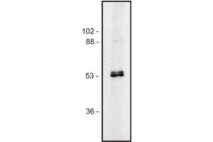 Western blot of human Jurkat T cell line (Alpha, beta-Tubulin Dimer anticorps)