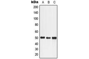 Western blot analysis of LTBR expression in HeLa (A), HuT78 (B), K562 (C) whole cell lysates. (LTBR anticorps  (N-Term))