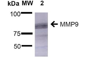 Western Blot analysis of Rat Brain showing detection of ~92 kDa and ~82 kDa (pro and active) MMP9 protein using Mouse Anti-MMP9 Monoclonal Antibody, Clone S51-82 . (MMP 9 anticorps  (AA 1-708) (APC))