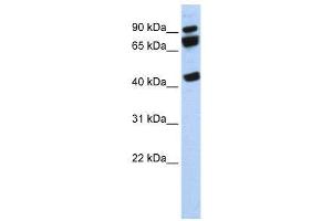 WB Suggested Anti-DDX17  Antibody Titration: 0. (DDX17 anticorps  (N-Term))