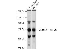 Western blot analysis of extracts of various cell lines, using Glucokinase (GCK) antibody (ABIN7267397) at 1:1000 dilution. (GCK anticorps  (AA 250-465))