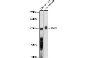 Western blot analysis of extracts of various cell lines, using B antibody (ABIN6133279, ABIN6137271, ABIN6137272 and ABIN6223276) at 1:1000 dilution. (ATG9B anticorps  (AA 715-924))