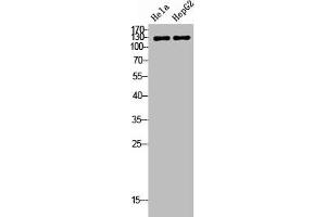 Western Blot analysis of HeLa HepG2 cells using TERT Polyclonal Antibody (TERT anticorps  (C-Term))