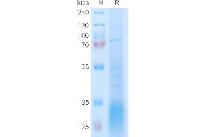 Human R Protein, His Tag on SDS-PAGE under reducing condition. (GLP2R Protein (AA 1-173) (His tag))