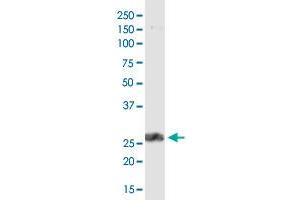 PDCD1LG2 monoclonal antibody (M46), clone 4G7. (PDCD1LG2 anticorps  (AA 19-121))