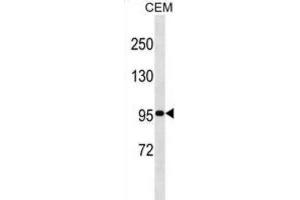 Western Blotting (WB) image for anti-Ubiquitin Specific Peptidase 1 (USP1) antibody (ABIN2999061) (USP1 anticorps)