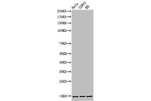 Western Blot analysis of HELA 22RV1 KB cells using Acetyl-Histone H3 (K27) Polyclonal Antibody (HIST1H3A/HIST2H3A/H3F3A (acLys27) anticorps)