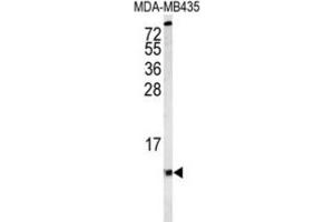 Western Blotting (WB) image for anti-Cytochrome C Oxidase Subunit VIa Polypeptide 1 (COX6A1) antibody (ABIN3004056) (COX6A1 anticorps)