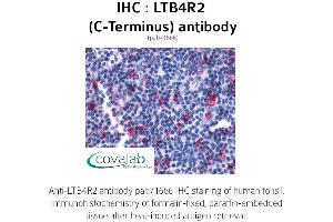 Image no. 1 for anti-Leukotriene B4 Receptor 2 (LTB4R2) (C-Term) antibody (ABIN1736595) (LTB4R2 anticorps  (C-Term))