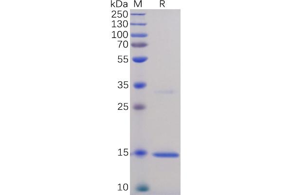 TNF alpha Protein (AA 77-233) (His tag)