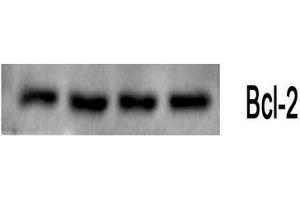 Western Blot (WB) analysis: Please contact us for more details. (Bcl-2 anticorps)