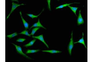 Immunofluorescence staining of Hela cells with ABIN7156645 at 1:100, counter-stained with DAPI. (MX2 anticorps  (AA 548-688))