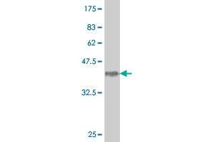 Western Blot detection against Immunogen (38. (HOXA5 anticorps  (AA 91-200))