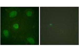 Immunofluorescence analysis of HeLa cells, using Hic-5 (Ab-60) Antibody. (TGFB1I1 anticorps  (AA 31-80))