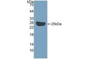 Detection of Recombinant Surv, Mouse using Polyclonal Antibody to Survivin (Surv) (Survivin anticorps  (AA 1-140))