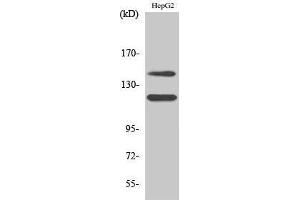 Western Blotting (WB) image for anti-Mast/stem Cell Growth Factor Receptor (KIT) (pTyr721) antibody (ABIN3179415) (KIT anticorps  (pTyr721))