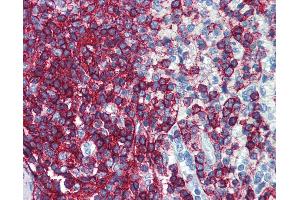 Anti-CD44 antibody IHC of human spleen. (CD44 anticorps  (FITC))