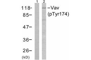 Western blot analysis of the extracts from Jurkat cells using Vav (phospho-Tyr174) antibody (E011142). (VAV1 anticorps  (pTyr174))